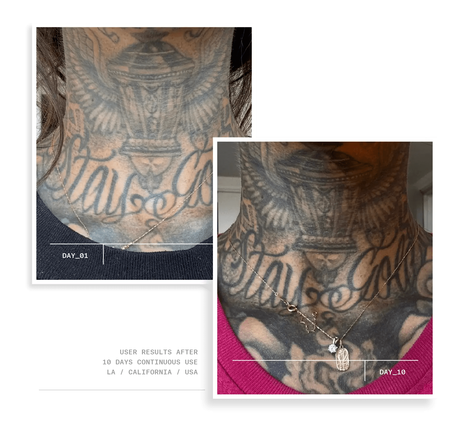 #270004,270006